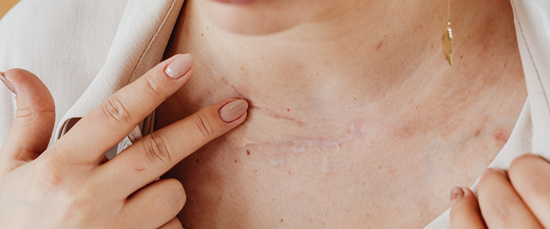 Get the Best Results With the Best Antibiotic Ointment for Cuts and Wound Healing
