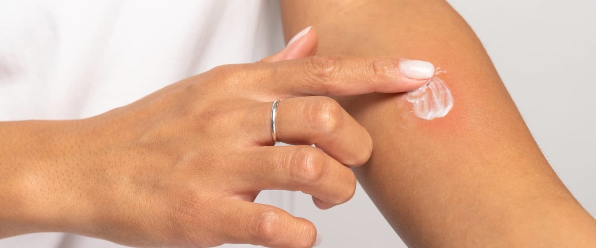 Treating Cuts and Sores? Find the Right Antibiotic for Wounds