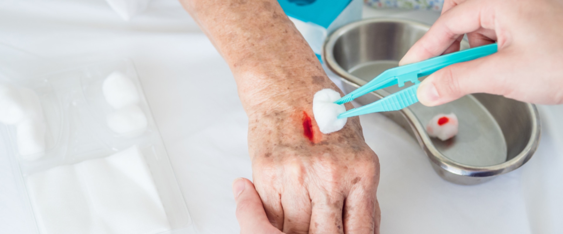 How Healing Works: Phases of Wound Healing That Restore Skin