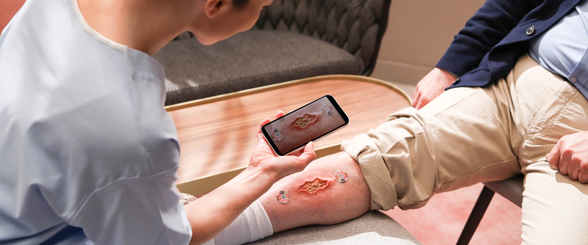 Granulation Tissue Wound Pictures Explained: Key Signs of Progress & Recovery Tips