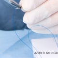 Dissolvable Stitches Healing Stages Explained for Faster Recovery