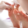 Don't Ignore These Signs! Diabetic Foot Gangrene Early Stages & Treatment