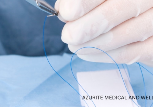 Dissolvable Stitches Healing Stages Explained for Faster Recovery