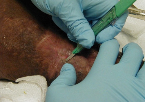 The Importance of Exudate in Wound Care