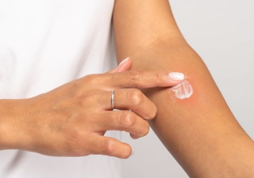 Treating Cuts and Sores? Find the Right Antibiotic for Wounds