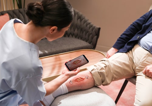 Granulation Tissue Wound Pictures Explained: Key Signs of Progress & Recovery Tips
